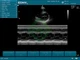 Аппарат УЗИ Edan U50 (для кардиологии, стандартный) вид 7